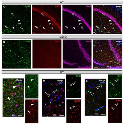 Metabolomics Based Identification of SIRT5 and Protein Kinase C Epsilon Regulated Pathways in Brain